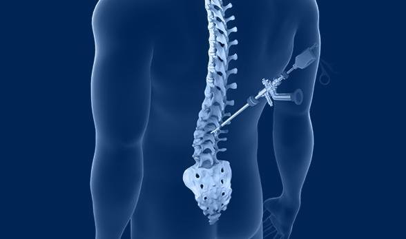 Spine Surgery